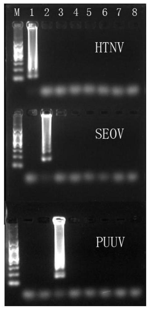 用于檢測(cè)漢坦病毒的檢測(cè)引物、檢測(cè)試劑盒及檢測(cè)方法