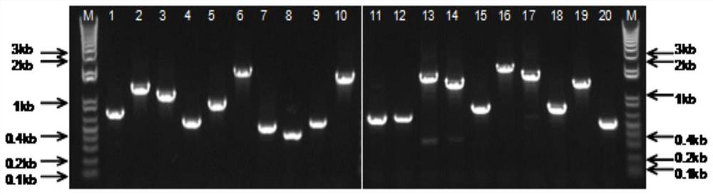 一種棘阿米巴特異性抗原肽、多克隆抗體及其用途