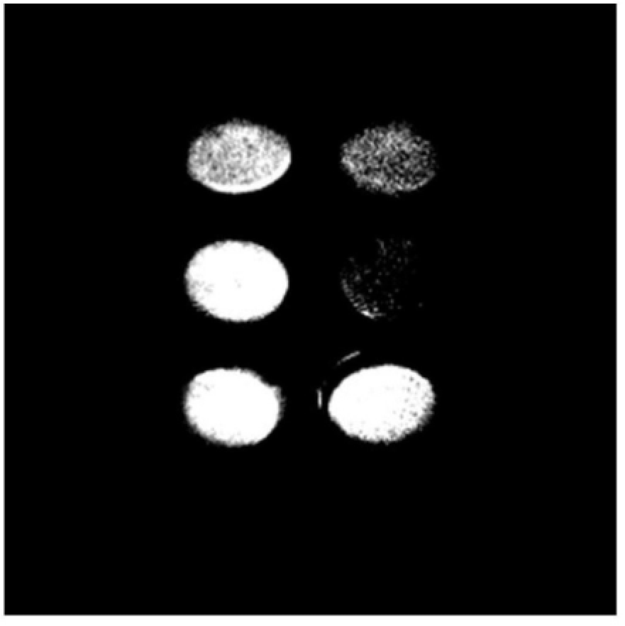 一種稀土微納米材料與甲殼素復(fù)合骨植入材料及制備方法